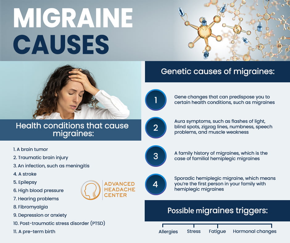 Migraine Causes