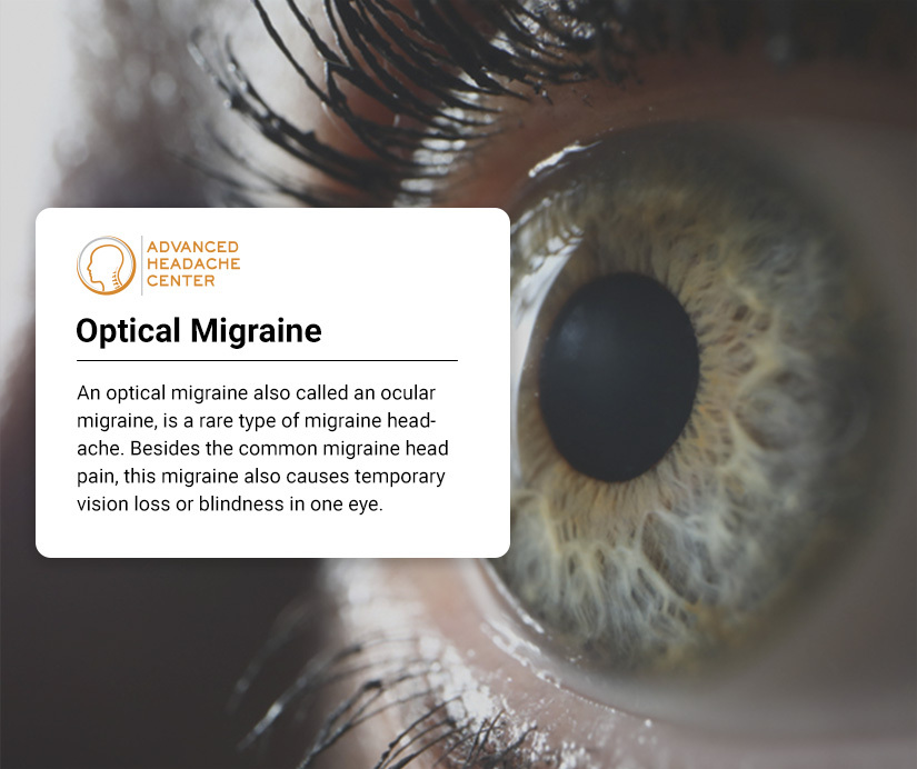Optical Migraine