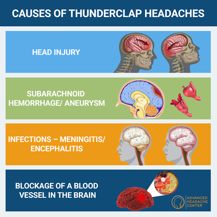 Causes of Thunderclap Headaches