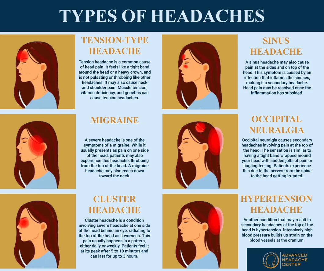 Common Types of Headaches to Worry About   Advanced Headache Center